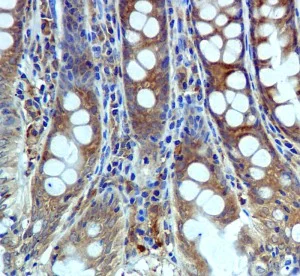Immunohistochemistry (Formalin/PFA-fixed paraffin-embedded sections) - Anti-USP10 antibody [EPR4261] (AB109219)