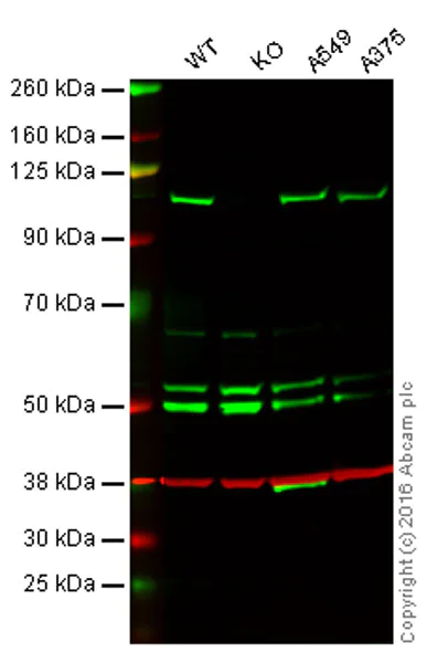 Western blot - Anti-USP10 antibody [EPR4261] (AB109219)
