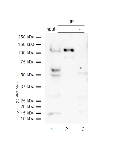Immunoprecipitation - Anti-USP10 antibody [EPR4261] - BSA and Azide free (AB239953)