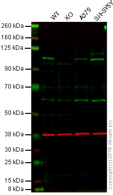 Western blot - Anti-USP13 antibody [EPR4348] (AB109264), expandable thumbnail