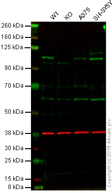 Western blot - Anti-USP13 antibody [EPR4348] (AB109264)