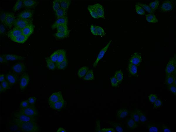 Immunocytochemistry/ Immunofluorescence - Anti-USP14/TGT antibody [28C4] (AB314182), expandable thumbnail
