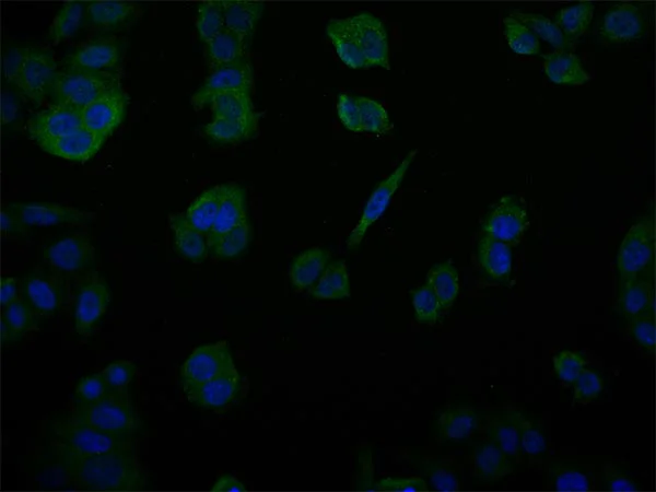 Immunocytochemistry/ Immunofluorescence - Anti-USP14/TGT antibody [28C4] (AB314182)
