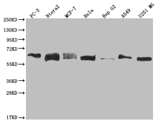 Western blot - Anti-USP14/TGT antibody [28C4] (AB314182)