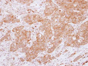 Immunohistochemistry (Formalin/PFA-fixed paraffin-embedded sections) - Anti-USP14/TGT antibody (AB137432)