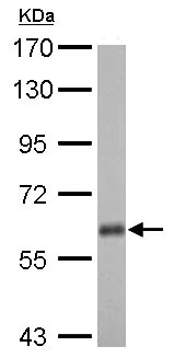Western blot - Anti-USP14/TGT antibody (AB137432)