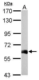 Western blot - Anti-USP14/TGT antibody (AB137432)