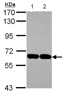 Western blot - Anti-USP14/TGT antibody (AB137432)