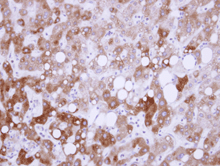 Immunohistochemistry (Formalin/PFA-fixed paraffin-embedded sections) - Anti-USP14/TGT antibody (AB137433), expandable thumbnail