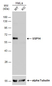 Western blot - Anti-USP14/TGT antibody (AB137433), expandable thumbnail