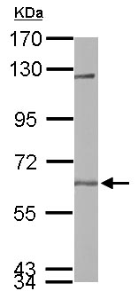 Western blot - Anti-USP14/TGT antibody (AB137433), expandable thumbnail