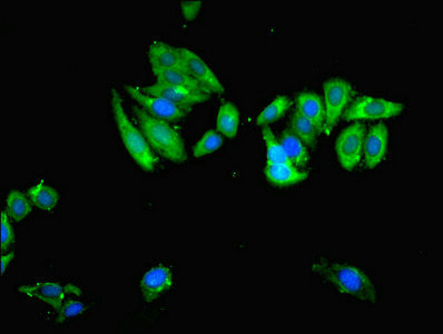 Immunocytochemistry/ Immunofluorescence - Anti-USP14/TGT antibody (AB235960), expandable thumbnail