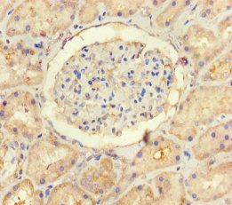 Immunohistochemistry (Formalin/PFA-fixed paraffin-embedded sections) - Anti-USP14/TGT antibody (AB235960), expandable thumbnail