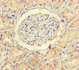 Immunohistochemistry (Formalin/PFA-fixed paraffin-embedded sections) - Anti-USP14/TGT antibody (AB235960)
