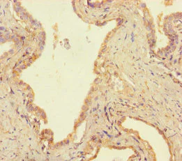 Immunohistochemistry (Formalin/PFA-fixed paraffin-embedded sections) - Anti-USP14/TGT antibody (AB235960)