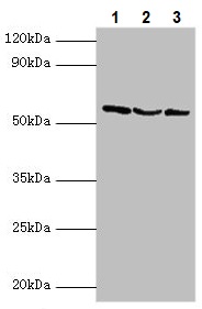 Western blot - Anti-USP14/TGT antibody (AB235960), expandable thumbnail