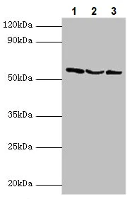 Western blot - Anti-USP14/TGT antibody (AB235960)