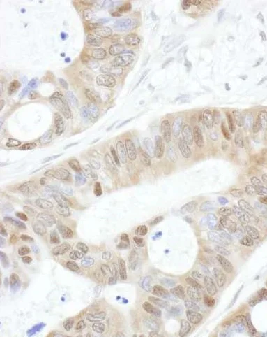 Immunohistochemistry (Formalin/PFA-fixed paraffin-embedded sections) - Anti-USP14/TGT antibody (AB246010)