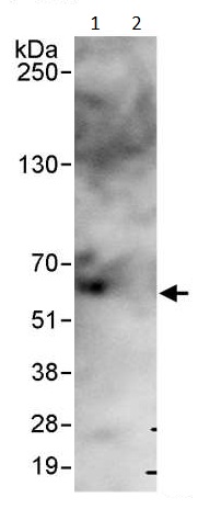Immunoprecipitation - Anti-USP14/TGT antibody (AB246010), expandable thumbnail