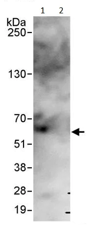 Immunoprecipitation - Anti-USP14/TGT antibody (AB246010)
