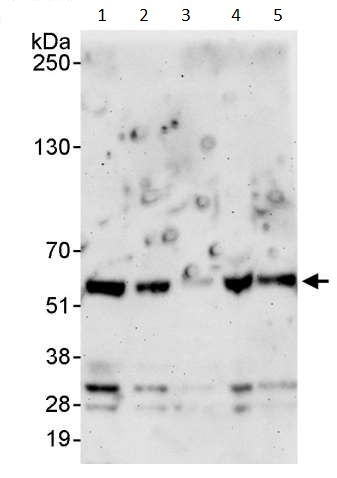 Western blot - Anti-USP14/TGT antibody (AB246010), expandable thumbnail