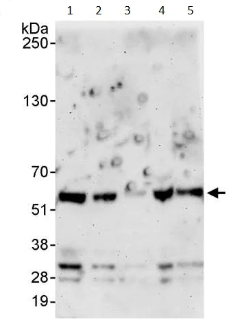 Western blot - Anti-USP14/TGT antibody (AB246010)
