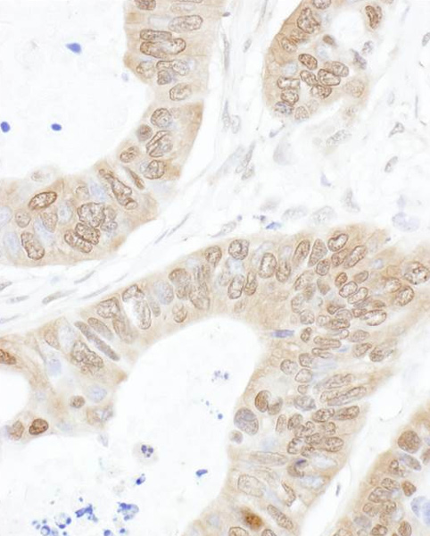 Immunohistochemistry (Formalin/PFA-fixed paraffin-embedded sections) - Anti-USP14/TGT antibody (AB71165), expandable thumbnail