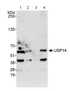 Western blot - Anti-USP14/TGT antibody (AB71165), expandable thumbnail