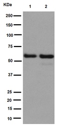 Western blot - Anti-USP14/TGT antibody [EPR15943] - BSA and Azide free (AB251149), expandable thumbnail