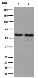 Western blot - Anti-USP14/TGT antibody [EPR15943] - BSA and Azide free (AB251149)