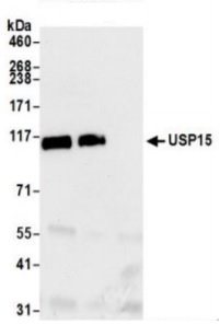 Immunoprecipitation - Anti-USP15 antibody (AB71713), expandable thumbnail