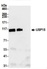 Immunoprecipitation - Anti-USP15 antibody (AB71713)