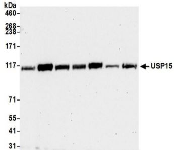 Western blot - Anti-USP15 antibody (AB71713), expandable thumbnail