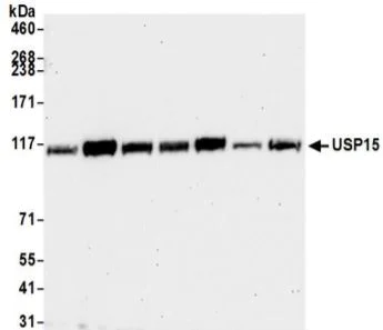 Western blot - Anti-USP15 antibody (AB71713)