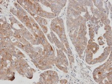 Immunohistochemistry (Formalin/PFA-fixed paraffin-embedded sections) - Anti-USP15 antibody (AB97533), expandable thumbnail