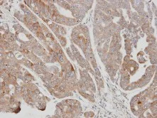Immunohistochemistry (Formalin/PFA-fixed paraffin-embedded sections) - Anti-USP15 antibody (AB97533)
