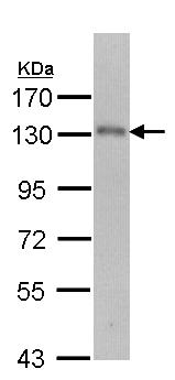 Western blot - Anti-USP15 antibody (AB97533), expandable thumbnail
