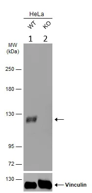 Western blot - Anti-USP15 antibody (AB97533)