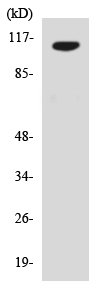 Western blot - Anti-USP15 antibody - N-terminal (AB138322)