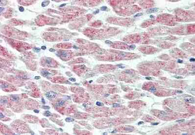 Immunohistochemistry (Formalin/PFA-fixed paraffin-embedded sections) - Anti-USP19 antibody (AB167059)