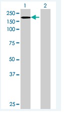 Western blot - Anti-USP19 antibody (AB68527), expandable thumbnail