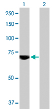 Western blot - Anti-USP2 antibody (AB168945)