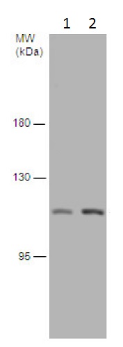 Western blot - Anti-USP20 antibody (AB229781)