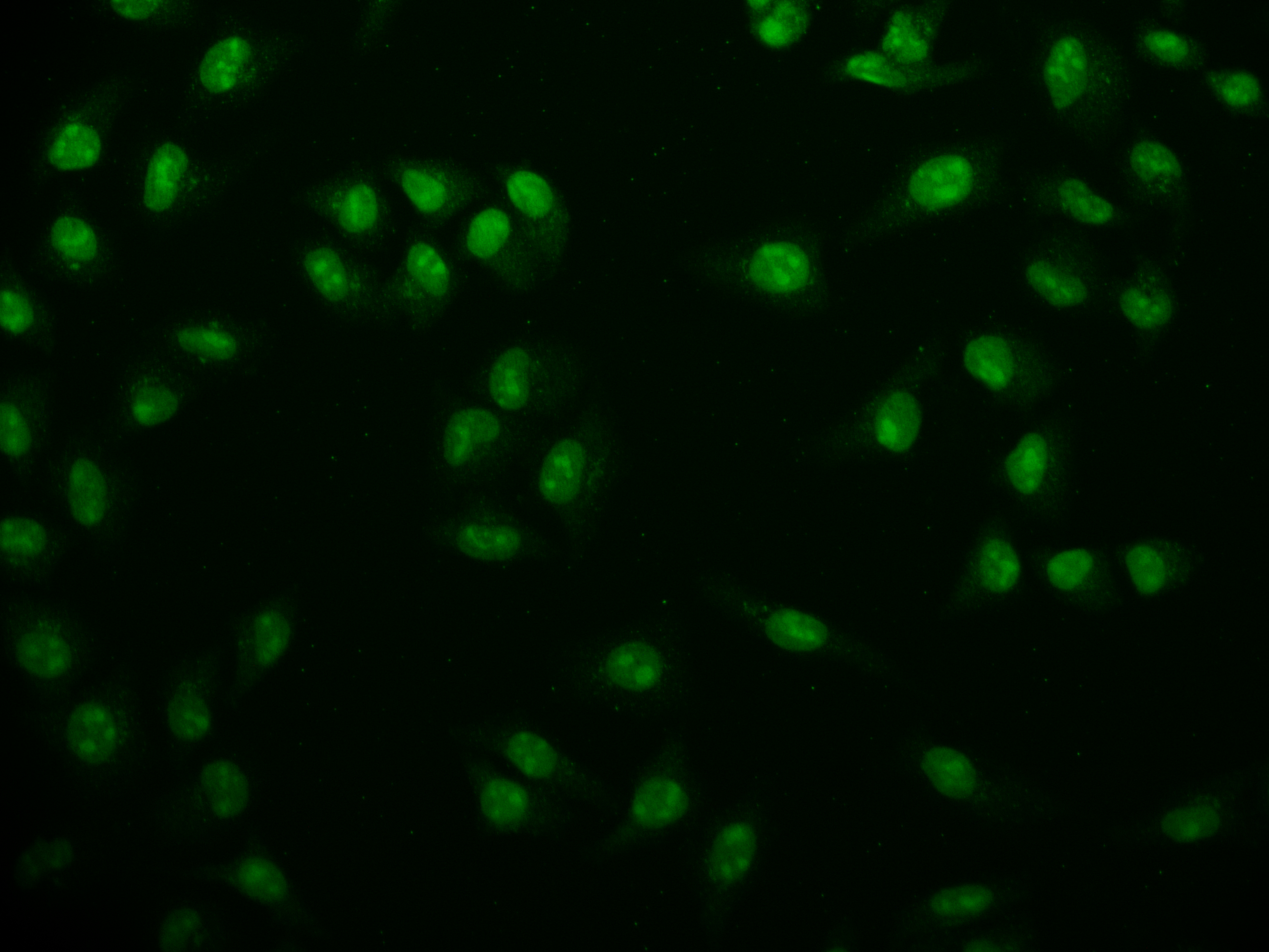 Immunocytochemistry/ Immunofluorescence - Anti-USP22 antibody [18H6] (AB314177), expandable thumbnail