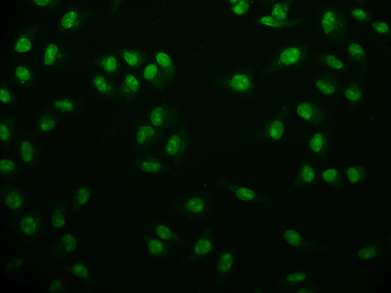 Immunocytochemistry/ Immunofluorescence - Anti-USP22 antibody [18H6] (AB314177)