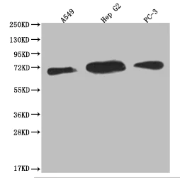 Western blot - Anti-USP22 antibody [18H6] (AB314177)
