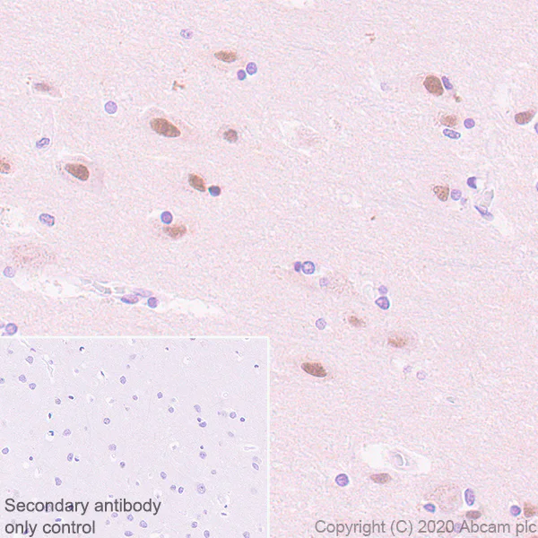 Immunohistochemistry (Formalin/PFA-fixed paraffin-embedded sections) - Anti-USP22 antibody [EPR18945] (AB195289)