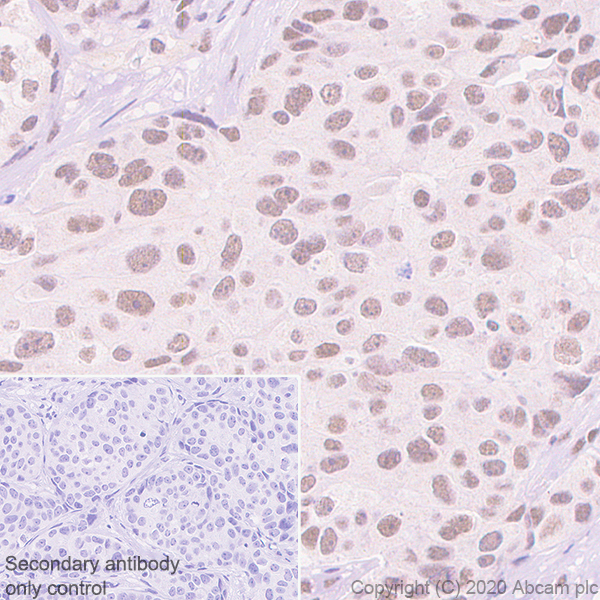 Immunohistochemistry (Formalin/PFA-fixed paraffin-embedded sections) - Anti-USP22 antibody [EPR18945] (AB195289)