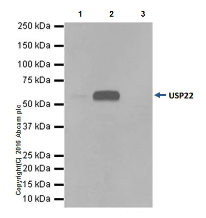 Immunoprecipitation - Anti-USP22 antibody [EPR18945] (AB195289)