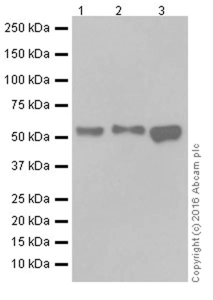 Western blot - Anti-USP22 antibody [EPR18945] (AB195289)